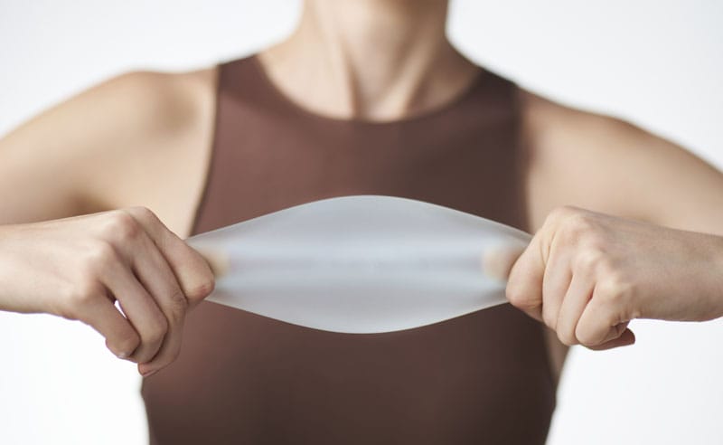 motiva-ergonomix2-implantate Motiva Ergonomix2® Implantate